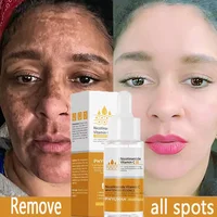 Powerful Dark Spots Remover Whitening Serum Face Freckle Melanin Correcting Anti Pigmentation Brighten Skin Beauty Care Products