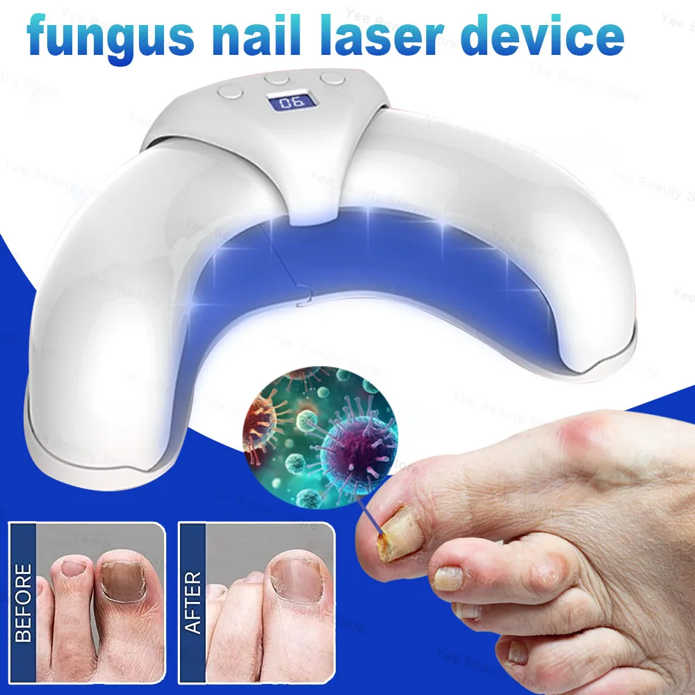 FungalNailLaserDeviceRepairFastNailsFungusOnychomycosisRepair