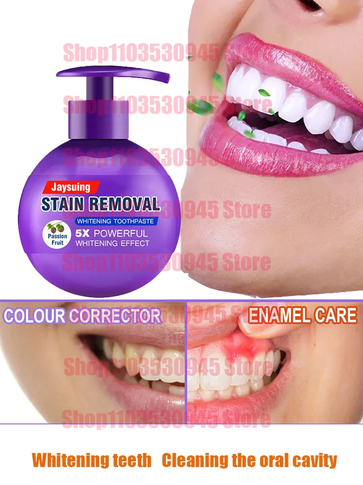 

Whitening teeth toothpaste dental calculus remover mouth odour removal bad breath Preventing Periodontitis fluoride toothpaste