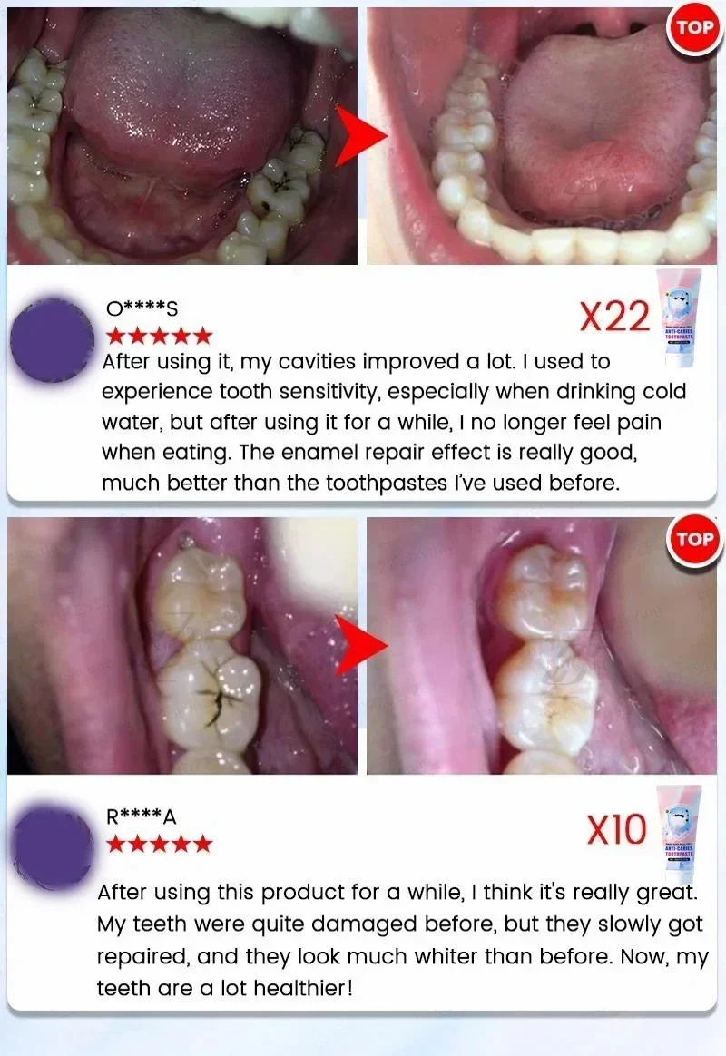 Dentifricio protezione denti 3-in-1 sbiancante e detergente_voghion.com