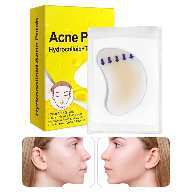 

Acne Pimple Patch Invisible Waterproof Absorb Pus Acne Pimple Remover Tool Acne Cleaner Skin Care Product