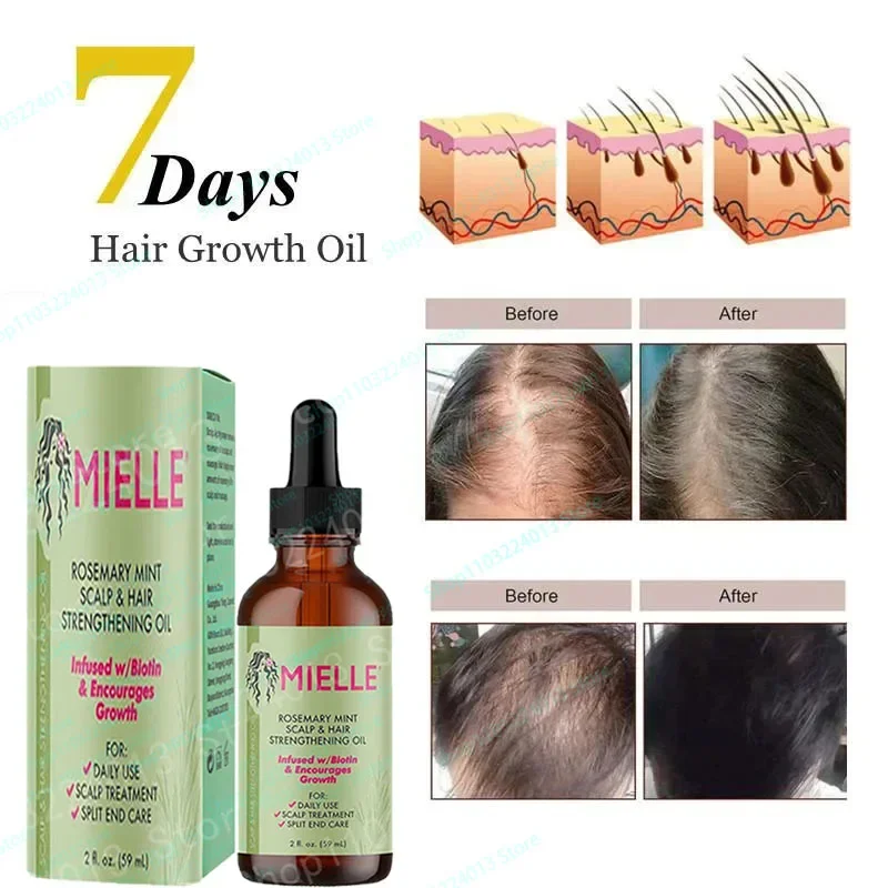 

Hair Growth Essential Oil Rosemary Mint Hair Strengthening Nourishing Treatment Split Ends Dry Mielle Organics Hair Care Product