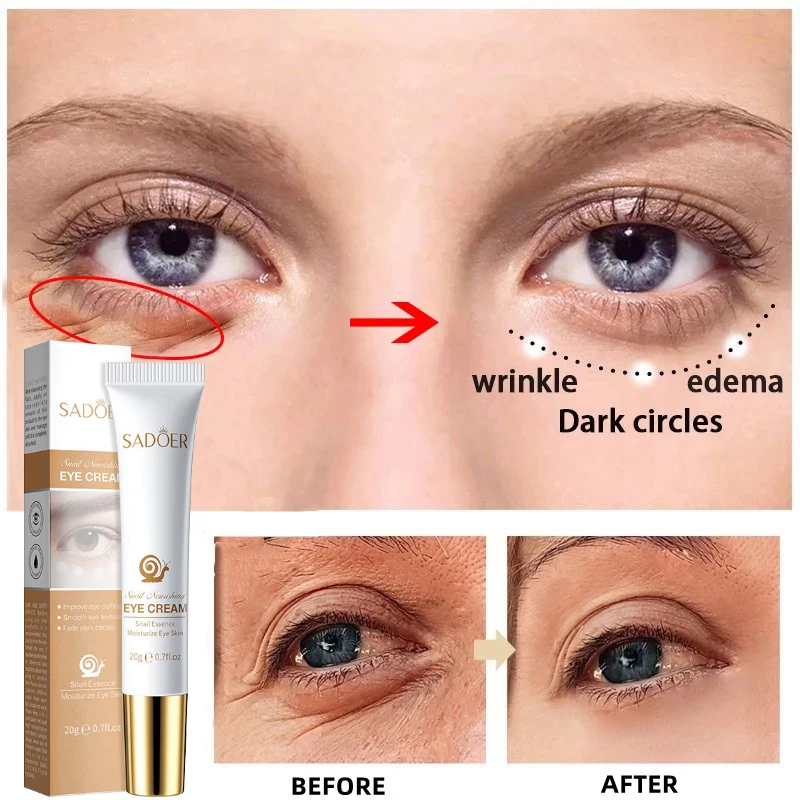 

Snail Anti Wrinkle Eye Cream Whitening Moisturizing Anti-Aging Remove Dark Circles Lifting Firming Anti-Puffiness Skin Care 20g