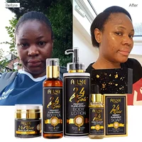 AILKE 24K Ensemble de blanchiment de la peau, éclaircissant, élimine les taches noires, la mélanine, les taches, même le teint, hydratant, pour tous les types de peau 1