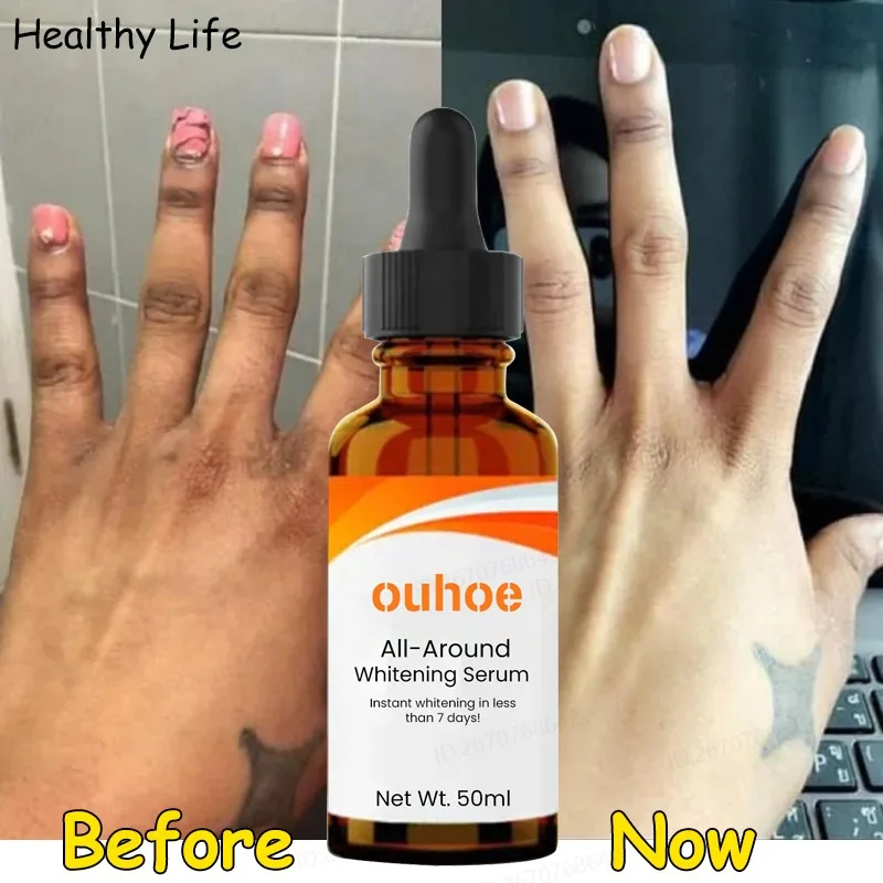 

Finger Joints Bleaching Serum Private Parts Knuckles Whitening Essence Knees Intimate Areas Brightening Body Lotion Fade Melanin