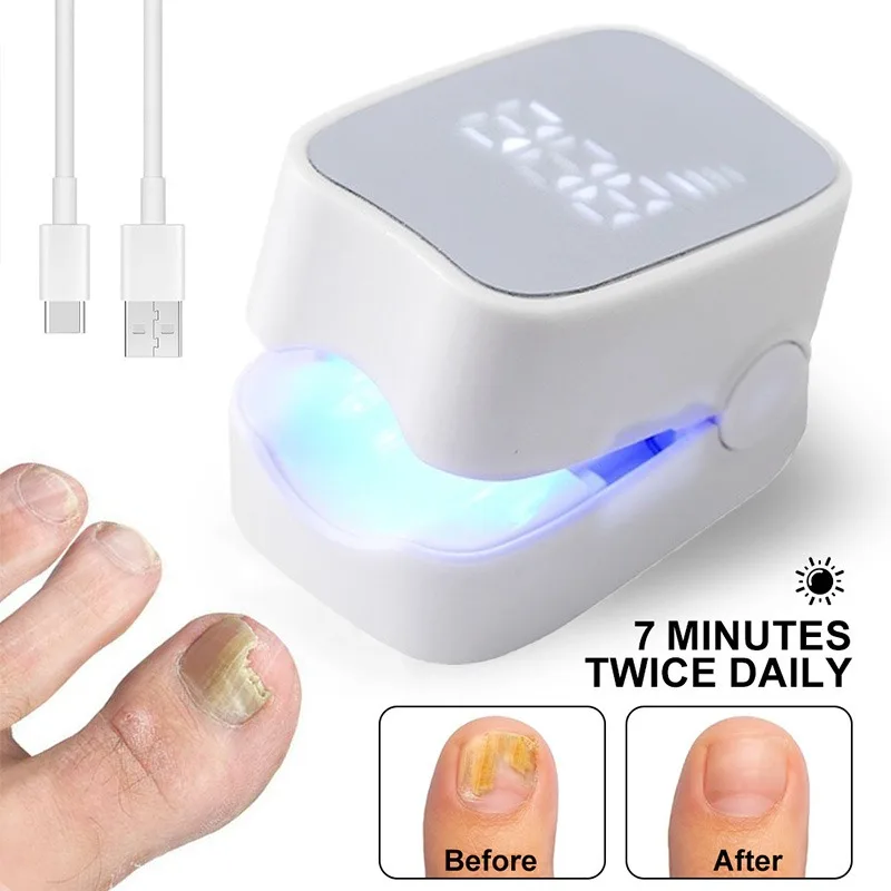 Blue Light Nail Fungus Treatment Device Portable Toenail Fingernail Care Toenail Onychomycosis Serum Toe Cure Effectively