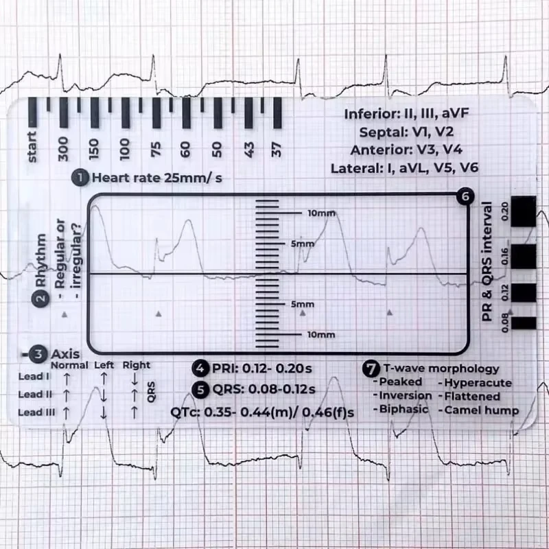 Ecg 7 Step Ruler 7 Step Scale for Ecg Observation Portable Transparent 7step Ruler Measurement Tool for Interpretation measurement tool