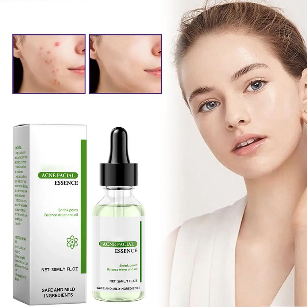 Serum Acne Remover Shrinking Pore Invisible Moisturizing Brighten Control Essence Liquid Oil Soothing Fac M2C1