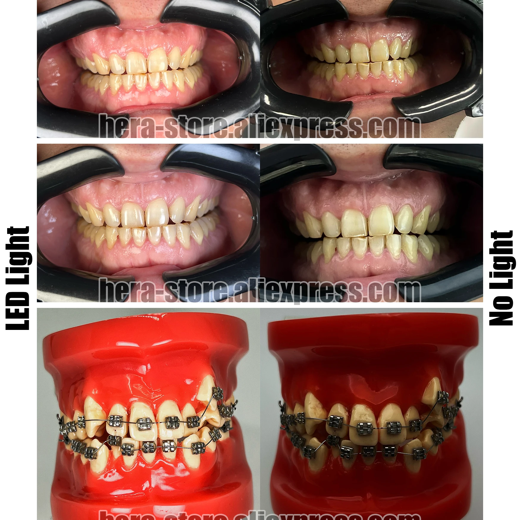 Extraoral Photographs Dental at Ben Birtwistle blog Extraoral Photographs Dental at Ben Birtwistle blog