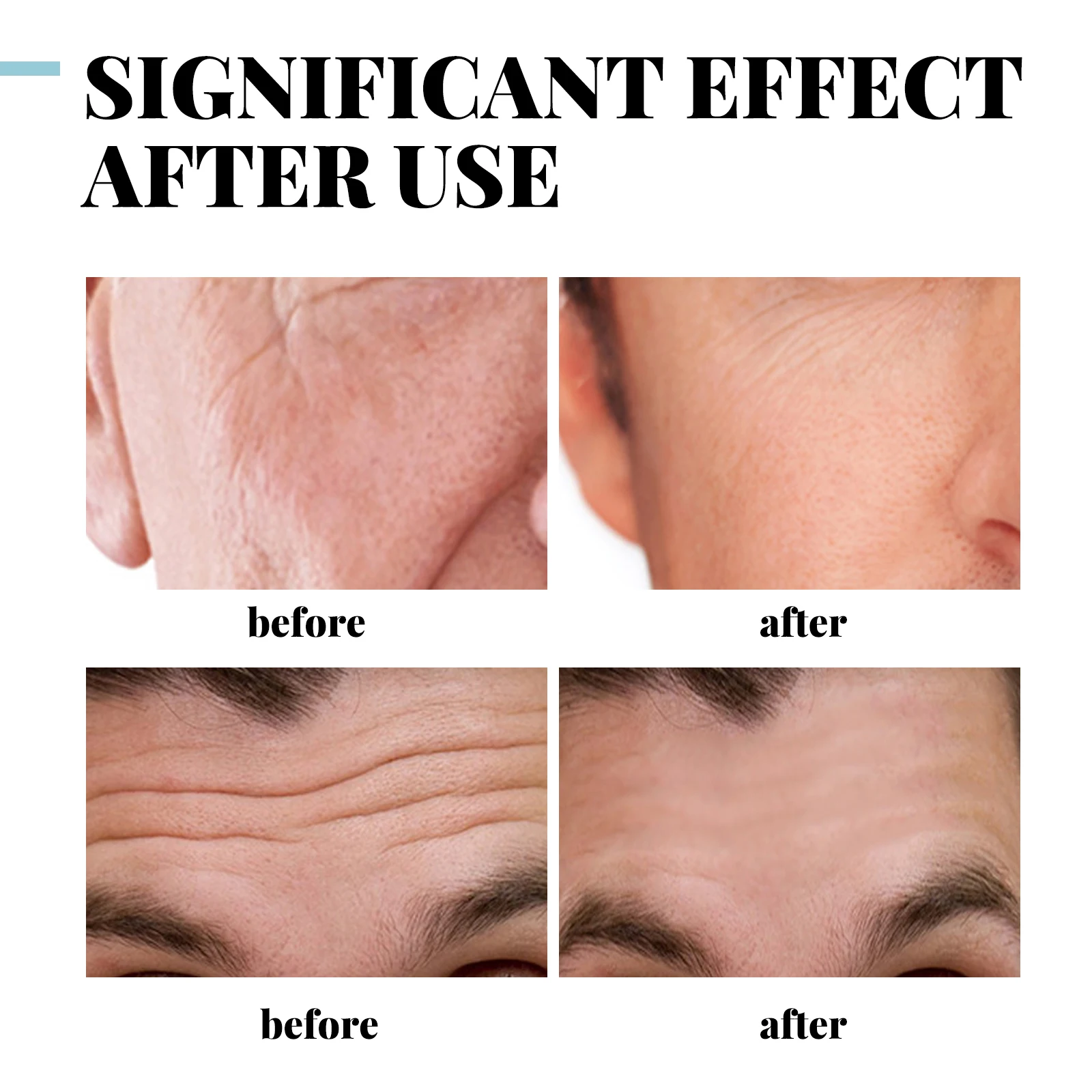 30/50g Men Anti-Wrinkle Facial Cream Retinol Collagen Moisturizing Anti-Aging Firming Facial Face Men Skin Tighting Care