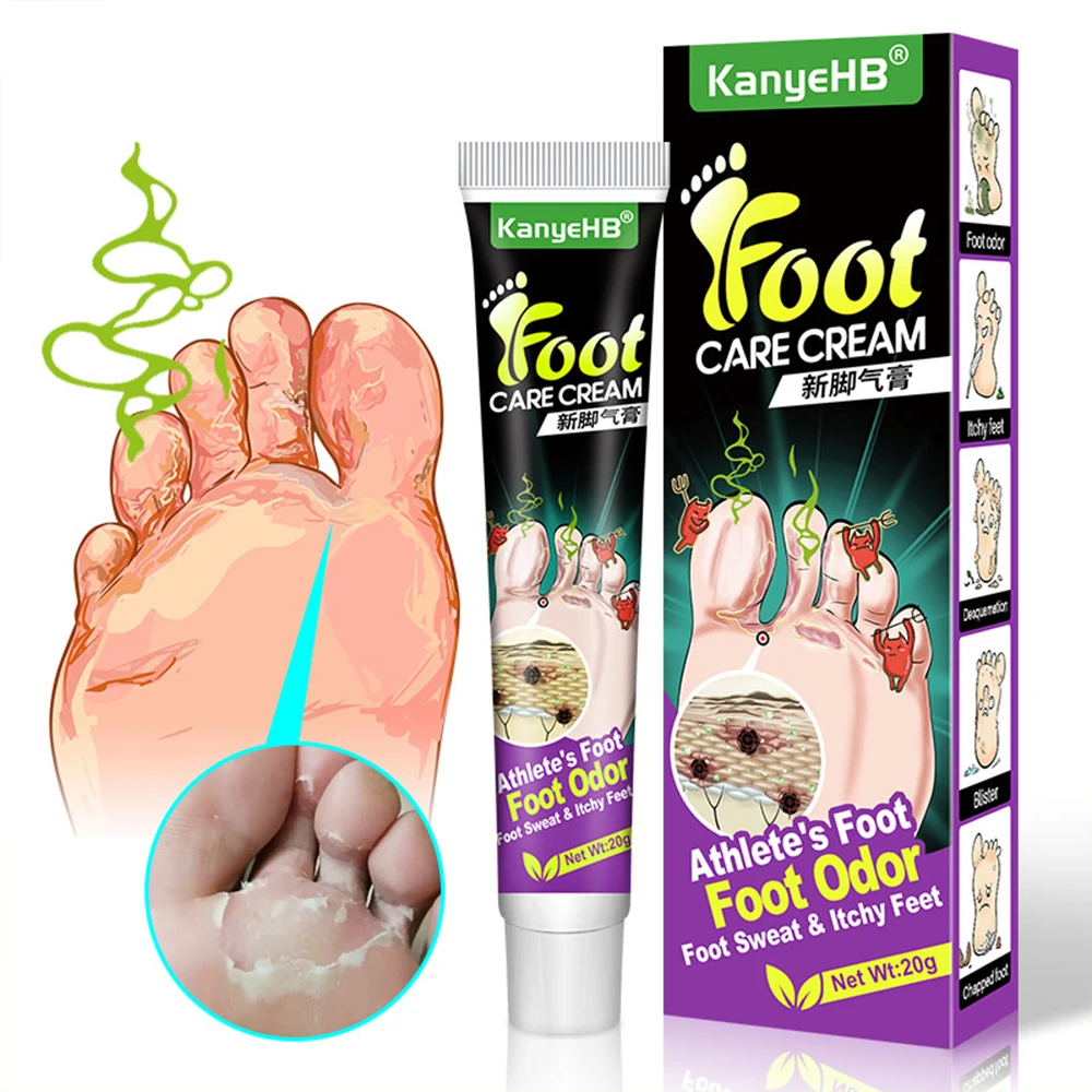 Anti-Foot Fungus Cream