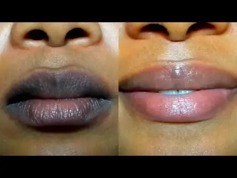 TURMERIC LEMON Lip Oil Dark Lips Remedy Lip Lightening Cream Balm for Lightening & Brightening Dark Lips Pink Cream