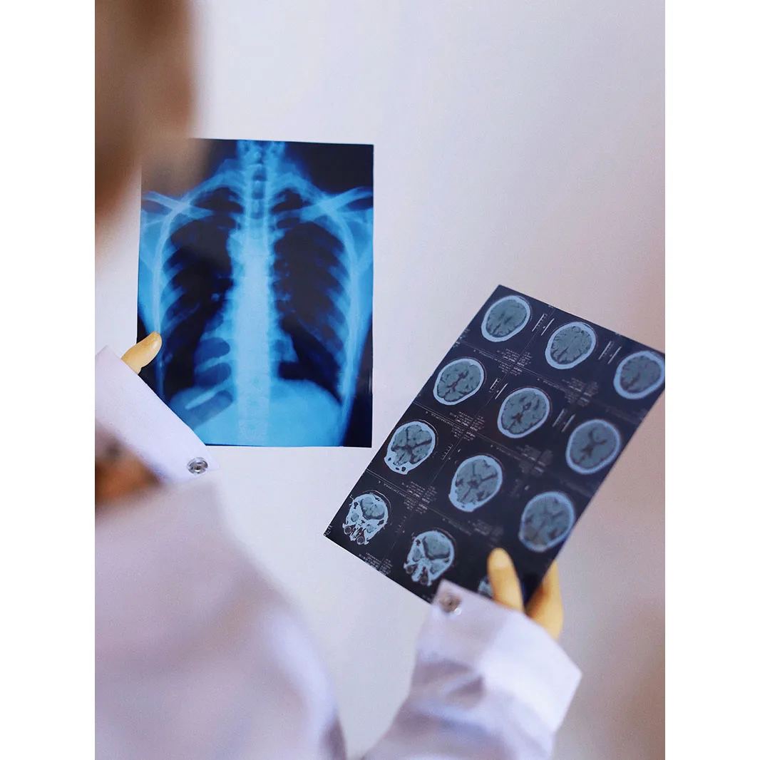 

BJD кукла мини рентгеновская пленка Prop файл карман для 1/3 24 "высокий SD17 SD DK DZ AOD DD фотография Бесплатная доставка