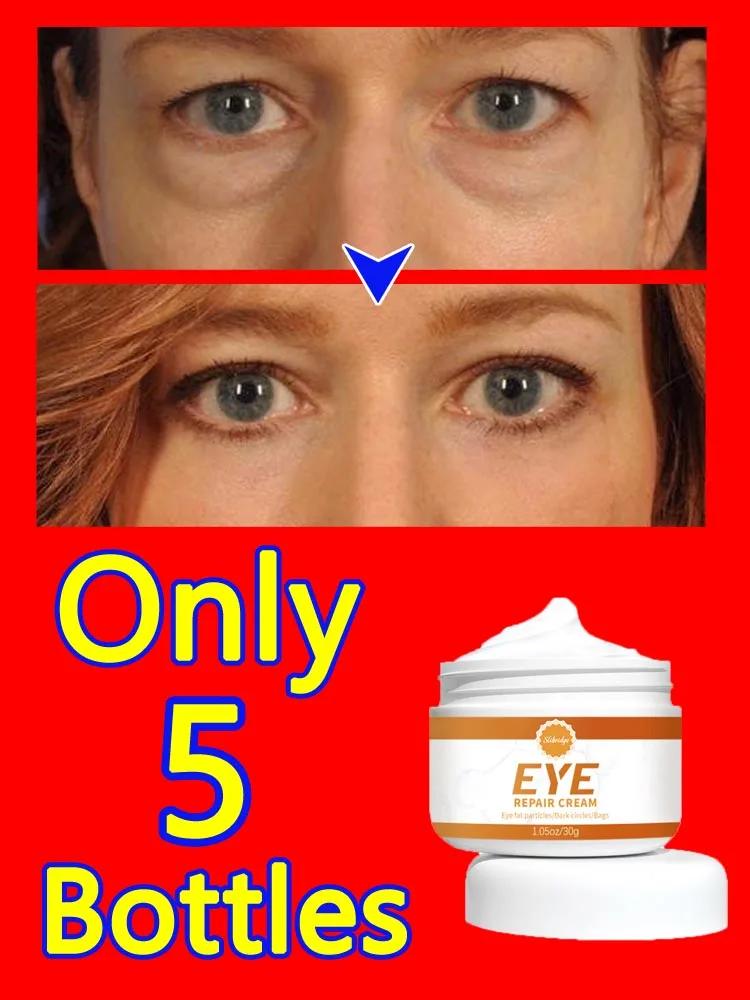 

Eye Bags Cream Improve Eyes Wrinkle