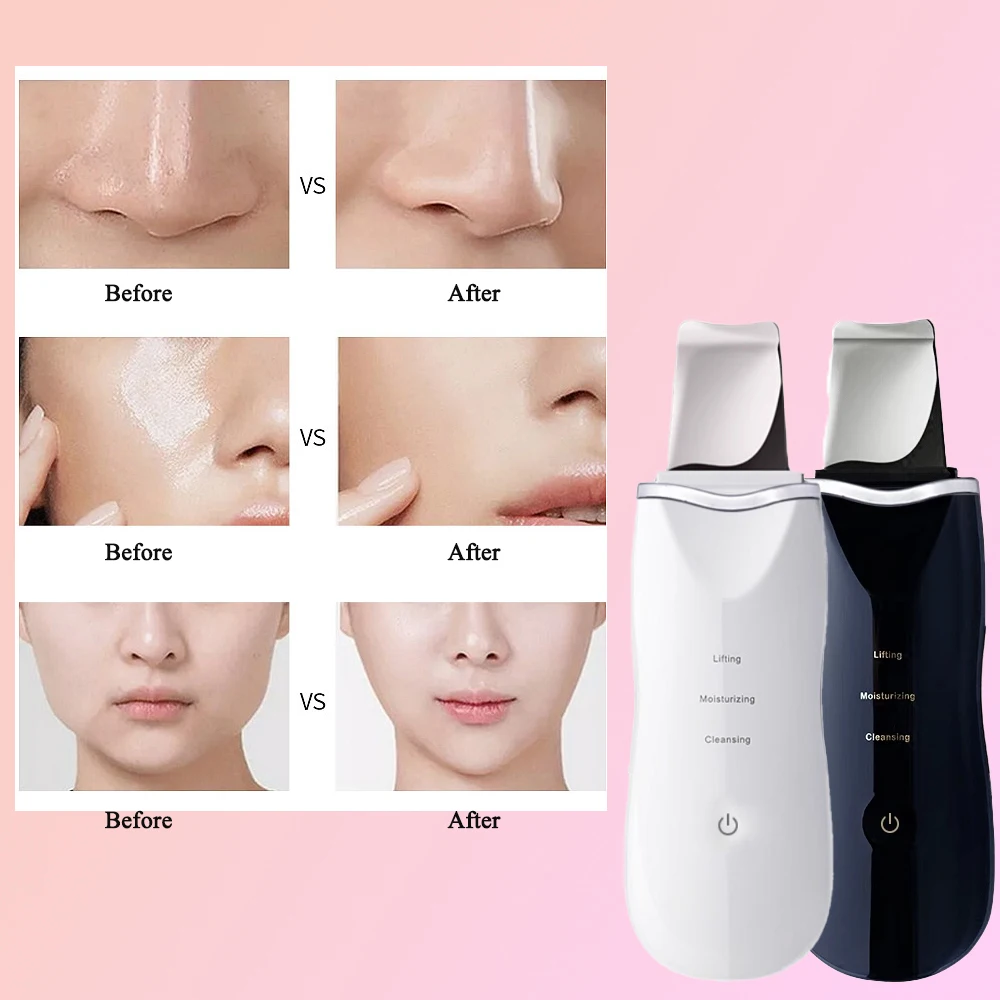Deep Cleaning Electric Skin Scrubber Blackhead Remover Facial Shovel Cleanser