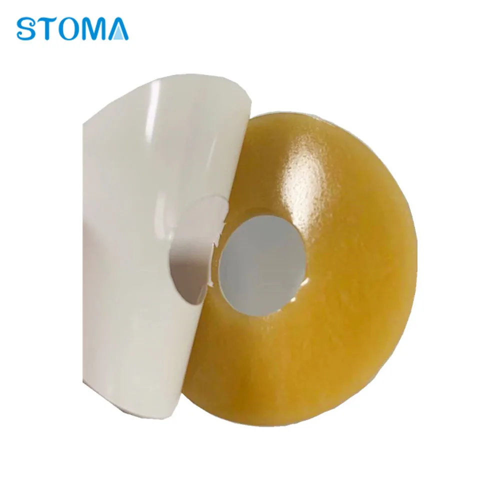 Ostomy Barrier Rings Seal for colostomy Bags, Modable Hydrocolloid