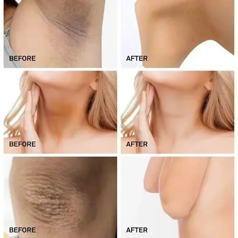 Remove Melanin Nicotinamide Brightening Cream For Dark Skin Effective Lighten Thigh Inner Bleach Private Parts Brighten Cream 3