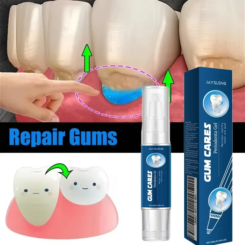 Gum Repair Drops Dental Calculus Remover Teeth Whitening Product Damaged Gum Repair Care Gel