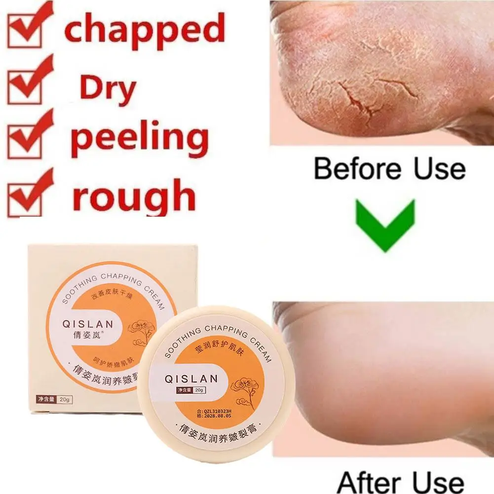 

20g Anti-Drying Crack Foot Cream Heel Cracked Repair Cream Removal Dead Skin Hand Feet Care For Cracked Hands Foot Spa O2L3