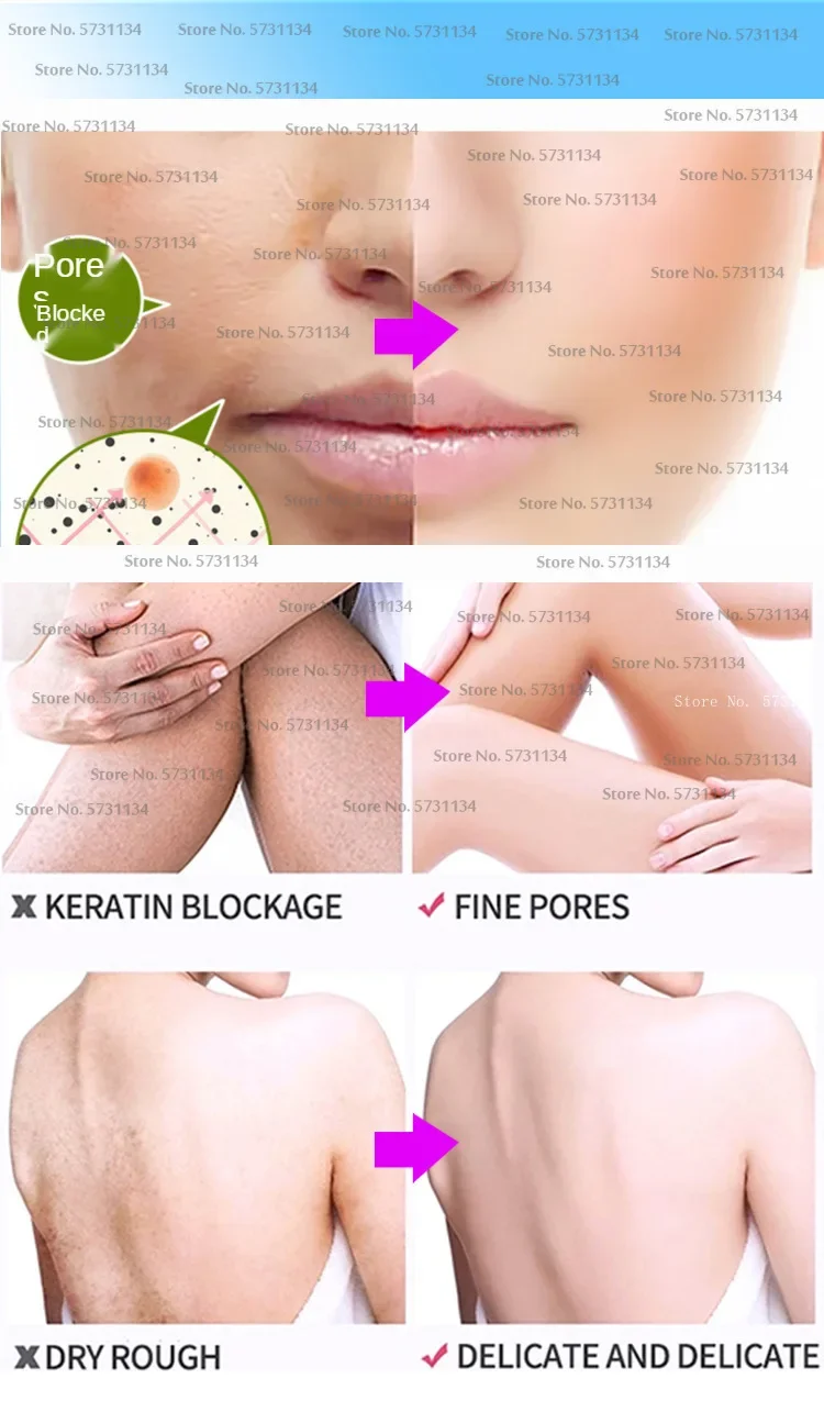 Organic Coffee Body Scrub Skin Reduce Cellulite Acne Whitening Exfoliating Brightening