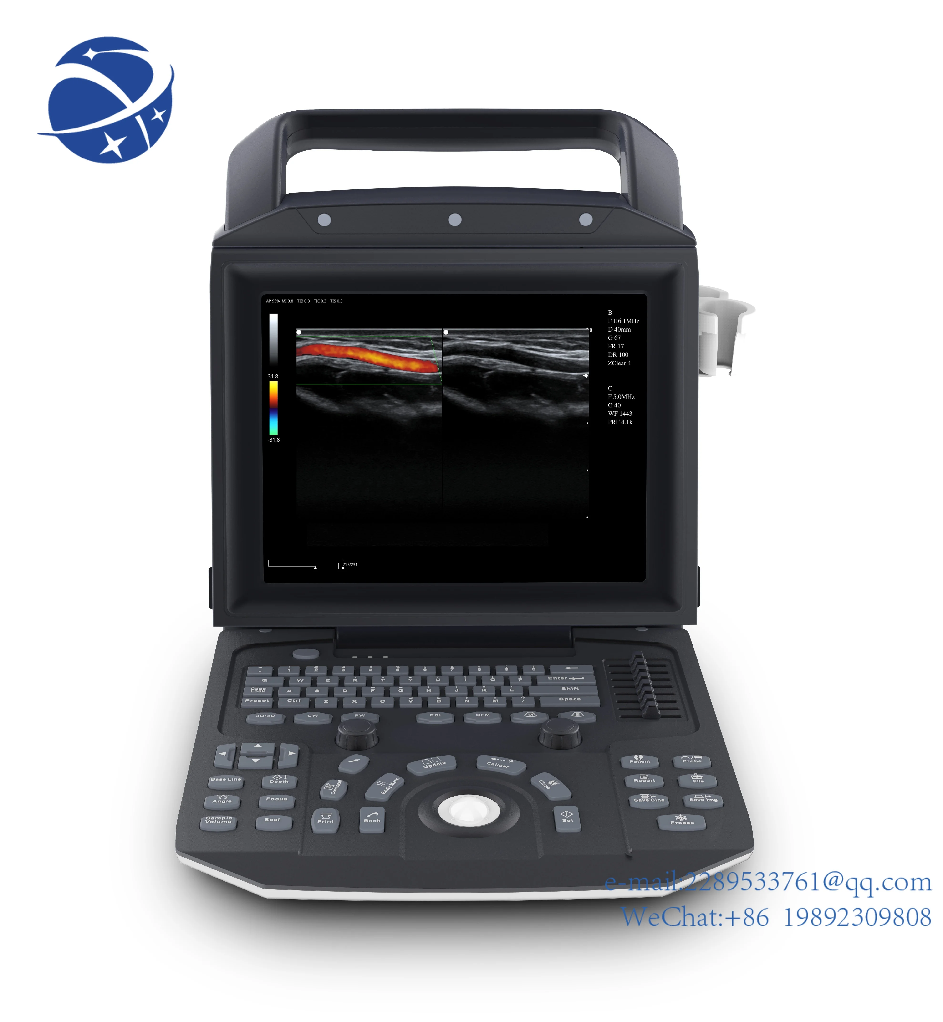 Yyhc Zoncare Ecografo 3D Ecografo 4D Color Doppler Ultrasuoni Prezzo Color Doppler Ultrasuoni Macchina Ad Ultrasuoni Colore