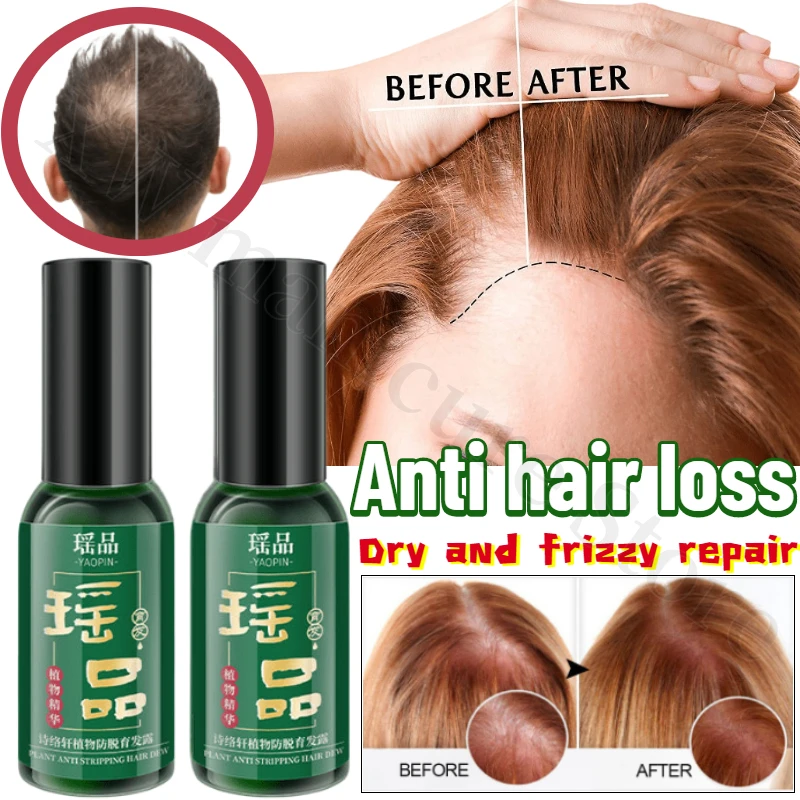 Polygonum Multiflorum Anti-hair Loss and Hair-fixing Essence Improves Thinning Hair Nourishes and Repairs Dry Frizzy Hair