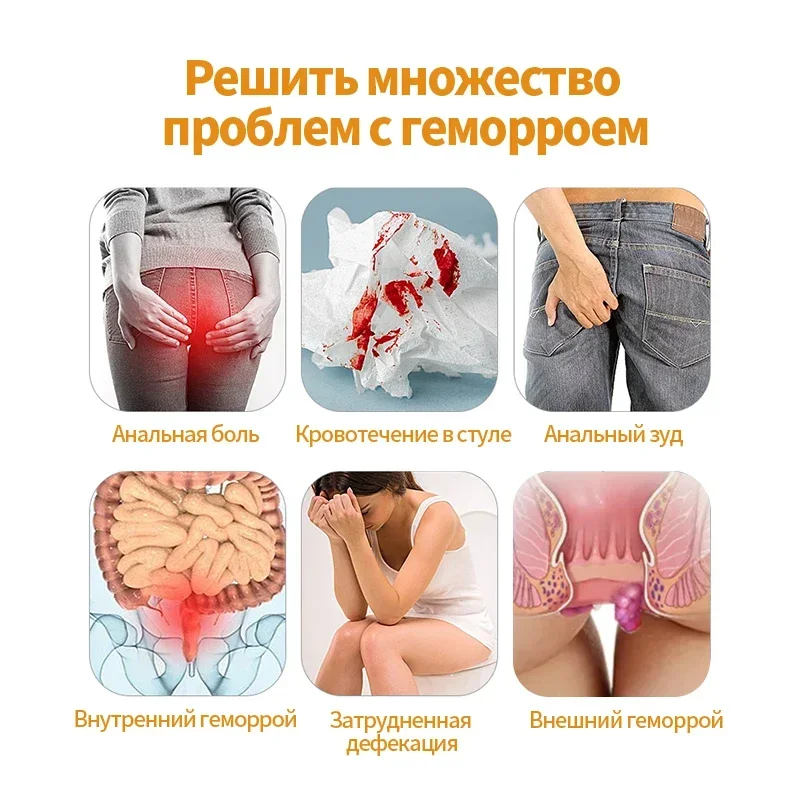 5CPS Hemorrhoids Treatment Herbal Cream for Russian Language Piles Medicine Hemorrhoid Removal Cure Anal Pain Swell Ointment hemorrhoids treatment cream