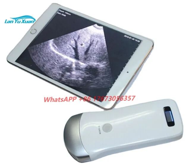 

Handheld Wifi Black And White Ultrasound Machine Android Ipad Wireless Convex Array Ultrasound Scanner Portable Abdomen Probe