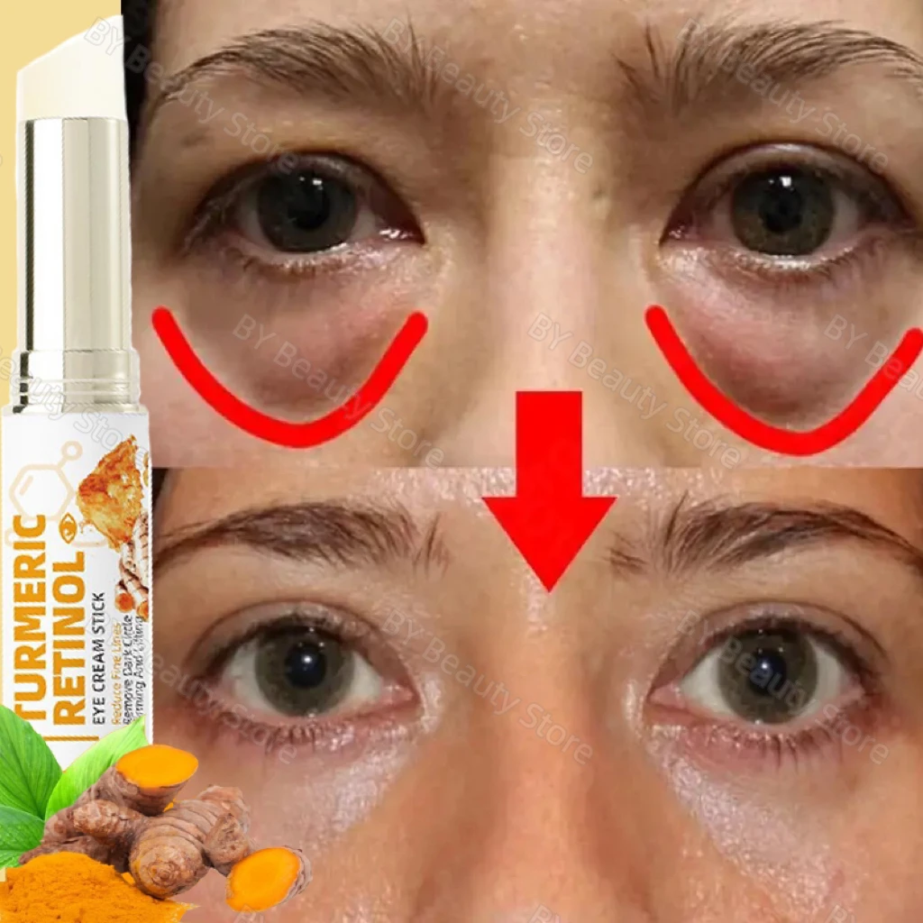 

Turmeric Remove Dark Circles Eye Cream Stick Anti-Wrinkle Fade Fine Lines Anti Eye Bags Puffiness Lift Firming Brighten Eye Care