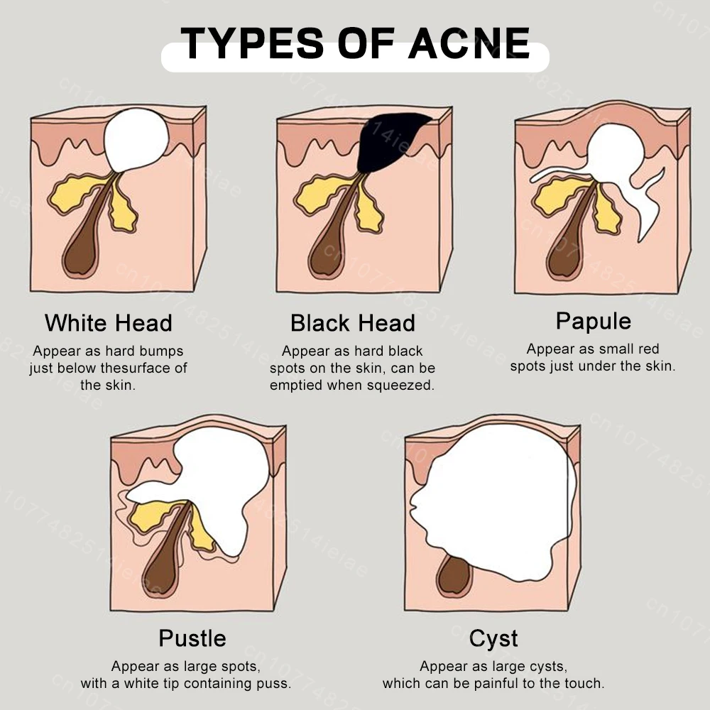Face Cream Shrink Pores Repair