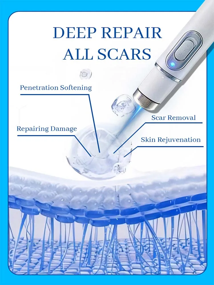 laser scar Suitable for all scar types