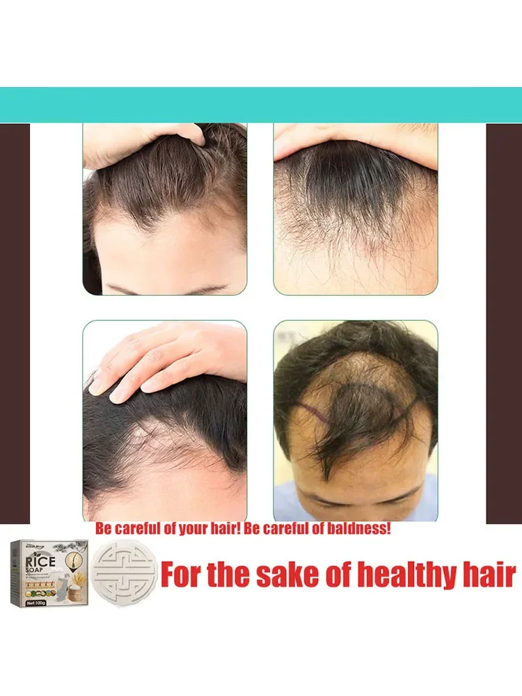 Anti Dropping, Nourishing, Firming,For the sake of hair , Protecting the scalp.Protecting the scalp and Nourishing Hair Roots