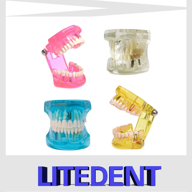 

Kindergarten Elementary School Teaching Tool School Teaching Dental Model Students Learn Tooth Molds