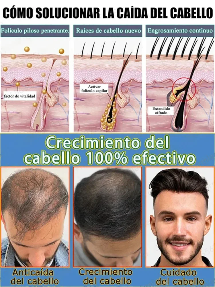 The Best Hair Growth Products of to Effectively Fix Baldness and Hair Loss
