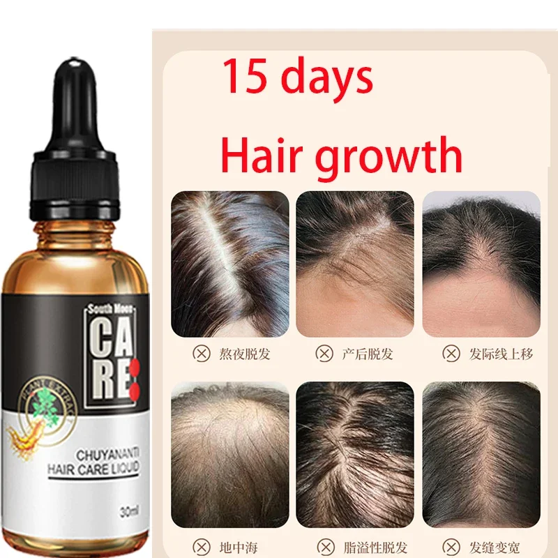 

Hair Nutrient Solution Hair Nourishing Root Hair Nourishing Solution Anti shedding essence