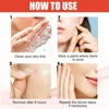 144pcs/set Face Skin Care Acne Pimple Patch 2 Sizes Invisible Professional Healing Absorbing Spot Sticker Covering for Men Women 5