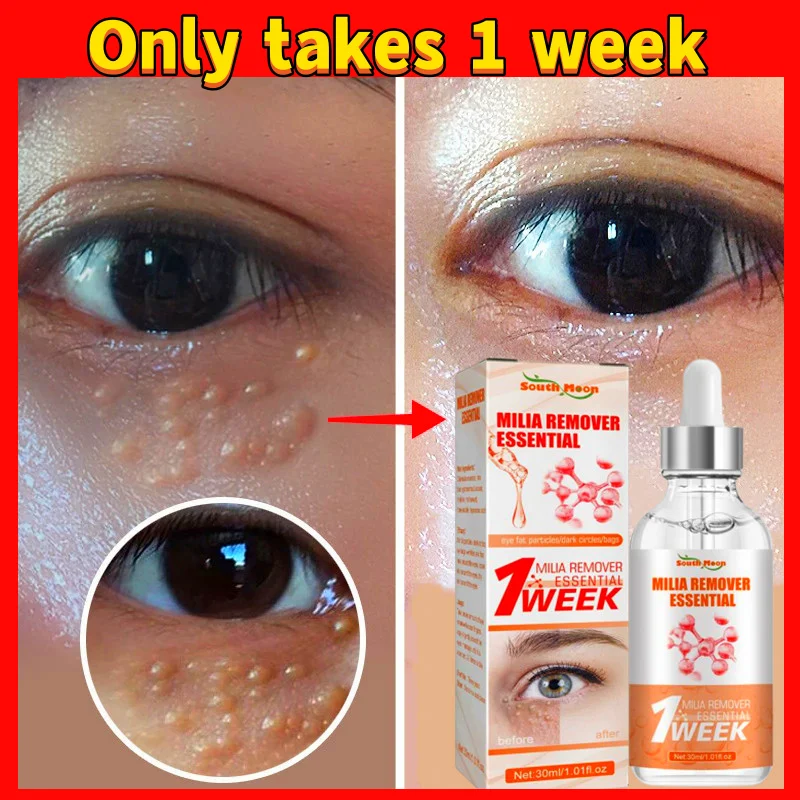Fat Granules Eyes Serum Antipuffiness Improve Eye Bag Fade Fine Lines