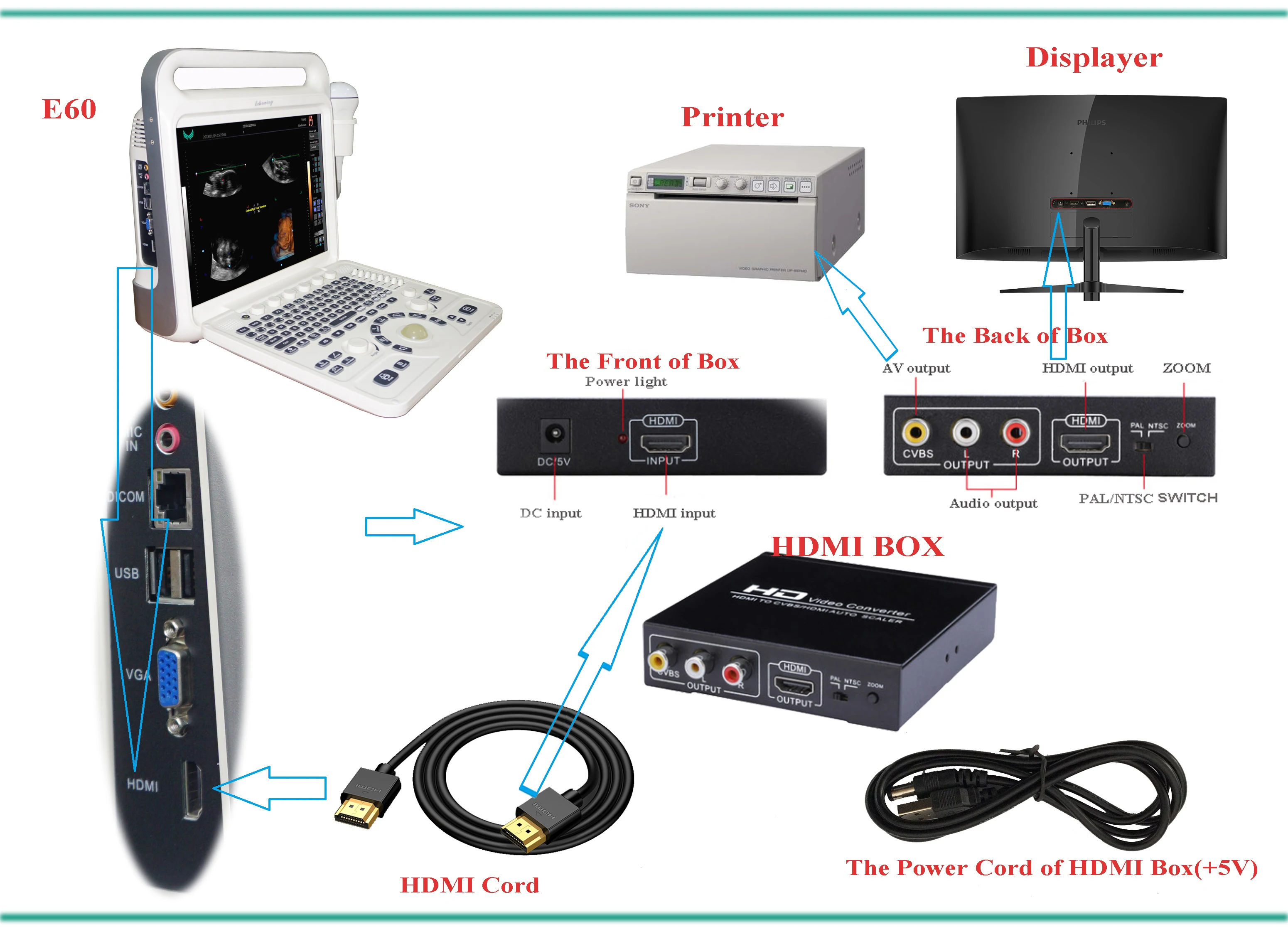 Biens diagnostiques de scanner d'ultrason de Digital de machine d