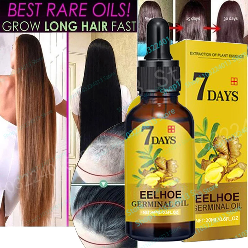 7 Days Fast Hair Growth Ginger Growth Hair Oil Treatment Anti Hair Loss Men Women Scalp Treatment Serum Products Beauty Health