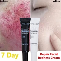 Crème réparatrice pour les rougeurs du visage, améliore la sécheresse des peaux sensibles, Lotion apaisante hydratante, élimination de la rosacea, cosmétiques coréens de jour et de nuit 1