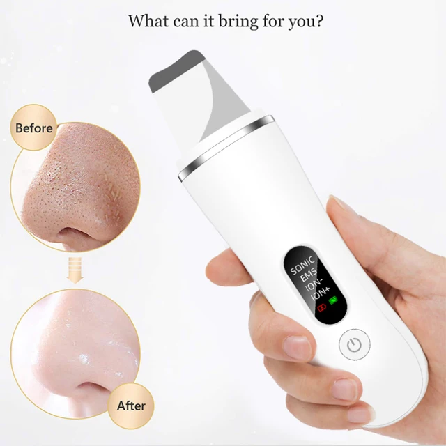 Neue Ultraschall Haut Wäscher Gesichts Tiefen Reinigung Mitesser Entfernen Ultraschall Reinigung Kavitation Peeling Schaufel Haut Wäscher