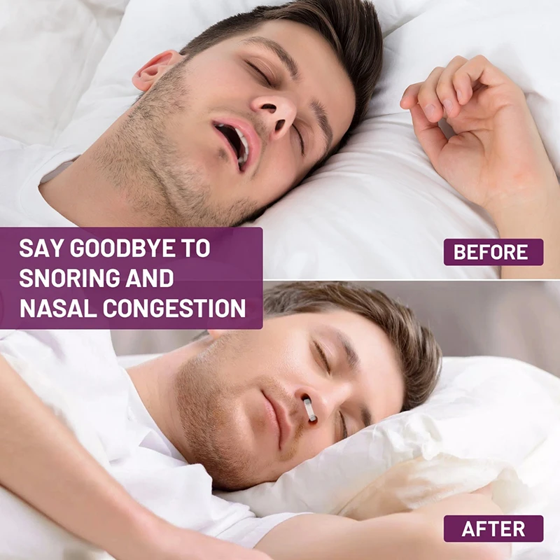 3Pcs Nasal Dilator For Snore Reduction Increase Airflow Anti Snoring Devices