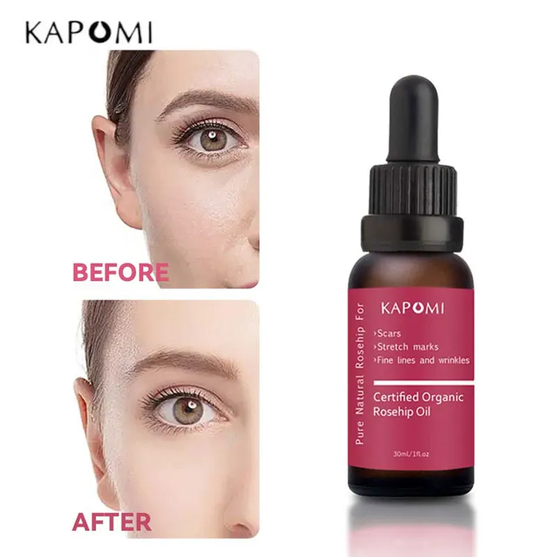 

Kapomi 100% Organic Pure Natural Rosehip Oil Unrefined Repair Scars Stretch Marks Anti-Wrinkles Whitening Remove Ance Anti-aging