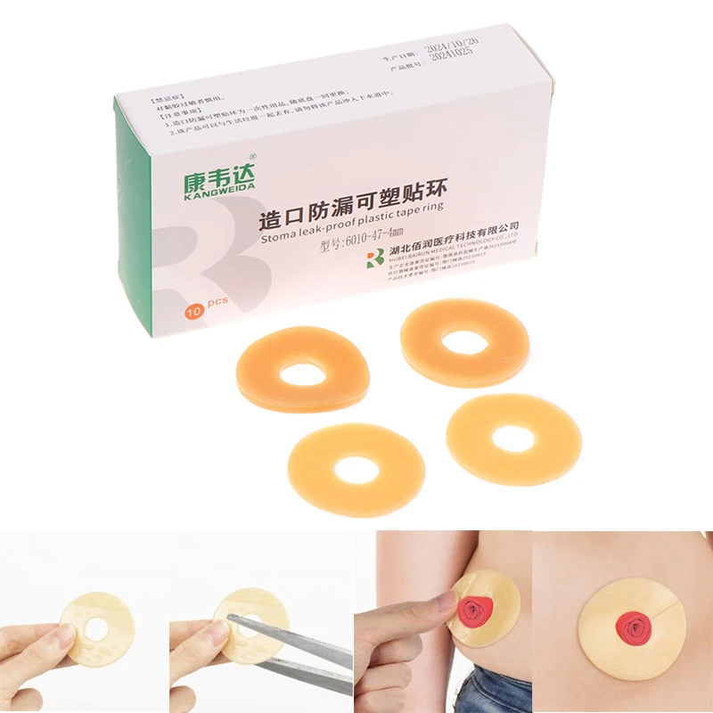 10Pcs Anti-Leakage Ring For Colostomy Bag Ostomy Paste Ring Baseplates Stoma Care Products To Protect Skin colostomy bags,ostomy barrier rings