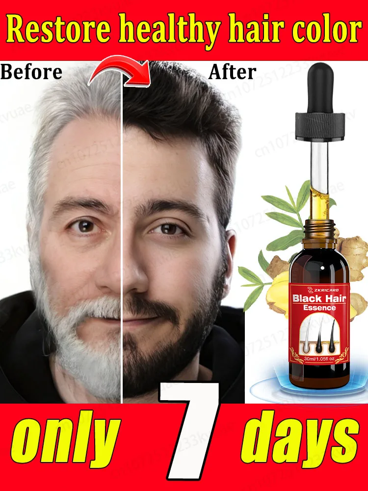 Hair Color Restorer White Hair Killer Used to turn white hair into black hair Nourish the scalp Suitable for white hair essence Repair care