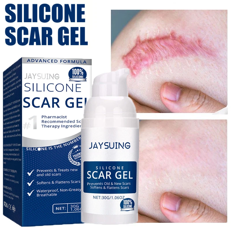

100% Silicone Scar Removal Cream Gel Burn Surgical Scar Cesarean Scar Repairing Stretch Marks Whitening Pigmentation Corrector