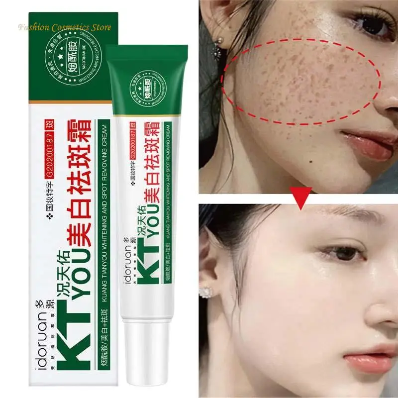 Whitening Freckle Cream Remove Melasma Dark Spot Fade Melanin Anti-Pigmentation Improve Dullness Brightening Skin Care