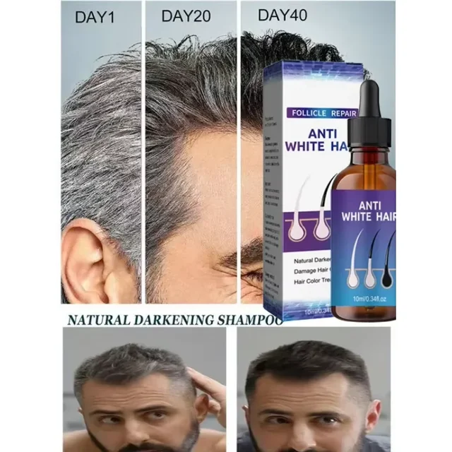 Gray White Hair Treatment Serum Liquid White To Black Natural Color Repair Nourishessence Anti-gray Anti Loss Care Men Women