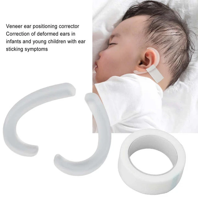 Corrector de oreja para bebé, Parche de corrección de silicona con