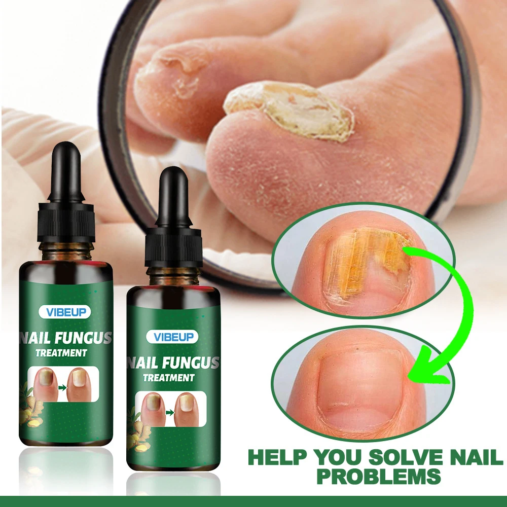 Fungal Nail Treatment Serum 7 Days Foot Nail Fungus Removal Repair Gel Anti Infection Paronychia Onychomycosis Foot Nails Care